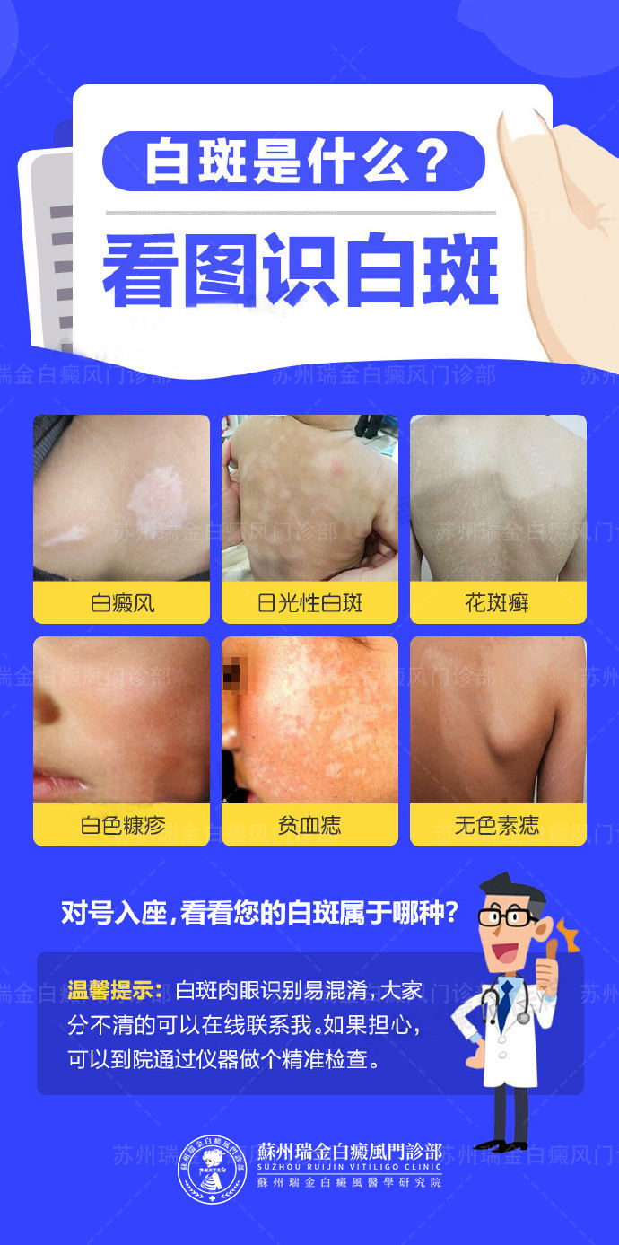 苏州瑞金白癜风医院